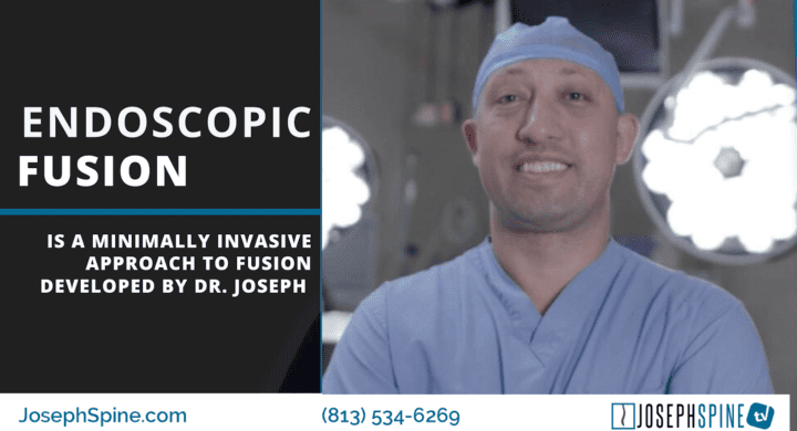 endoscopic fusion spine minimally invasive