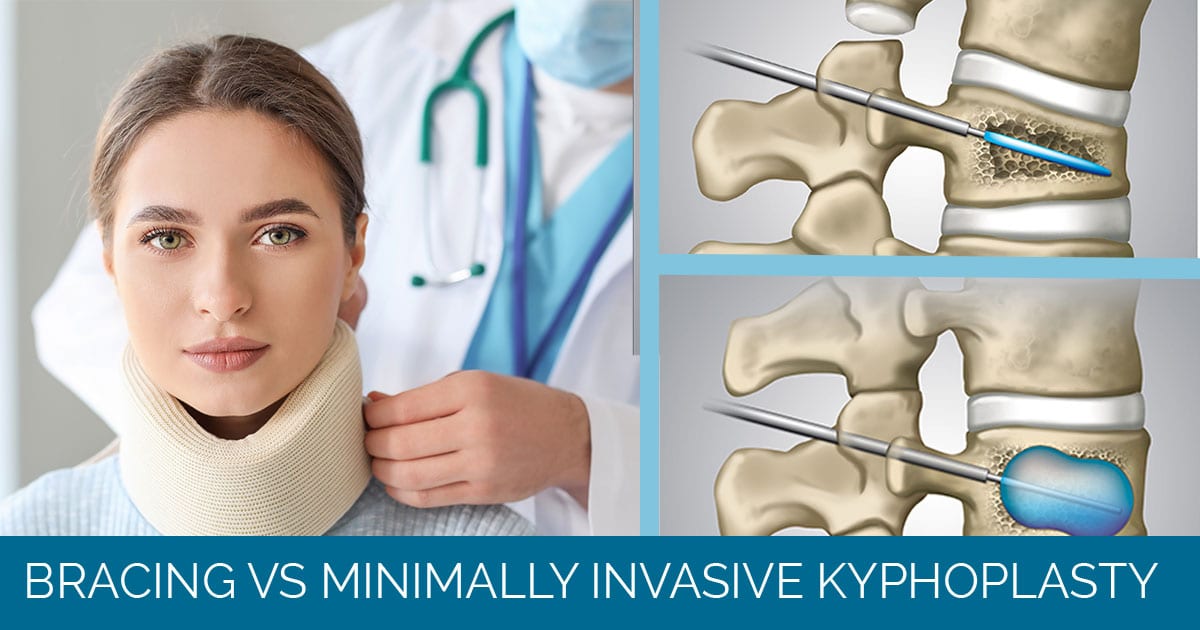 Kyphoplasty: What It Is, Purpose, Procedure & Side Effects