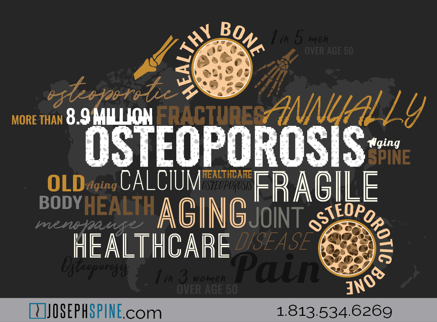 Osteoporosis is a disease of the bone, which literally means porous bone, and is a disease in which the density and quality of bone are reduced. As bones become more porous and fragile, the risk of fracture is greatly increased.